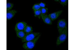 Immunofluorescence (Cultured Cells) (IF (cc)) image for anti-Signal Transducer and Activator of Transcription 6, Interleukin-4 Induced (STAT6) antibody (ABIN5557533)
