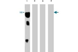 Western blot analysis of extract from red sea bream (lane 1) , carp (lane 2) , mummichog (lane 3) and medaka (lane 4) , using Vitellogenin monoclonal antibody, clone 5A4  . (Vitellogenin 2 抗体)