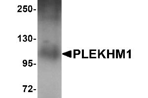 Western Blotting (WB) image for anti-Pleckstrin Homology Domain Containing, Family M (With RUN Domain) Member 1 (PLEKHM1) (N-Term) antibody (ABIN1031519) (PLEKHM1 抗体  (N-Term))