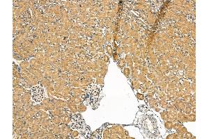 ABIN7094454 and ABIN7098502 at 1/100 staining Mouse kidney tissue by IHC-P. (SCD 抗体  (N-Term))