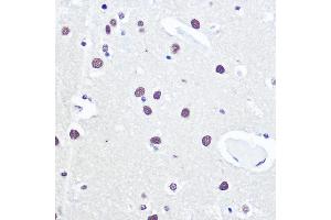 Immunohistochemistry of paraffin-embedded human brain using 53BP1 Rabbit pAb (ABIN6128833, ABIN6149414, ABIN6149415 and ABIN6221431) at dilution of 1:100 (40x lens). (TP53BP1 抗体  (AA 1763-1977))