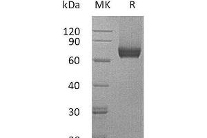 Western Blotting (WB) image for Interleukin 7 Receptor (IL7R) (Active) protein (Fc Tag) (ABIN7320744) (IL7R Protein (Fc Tag))