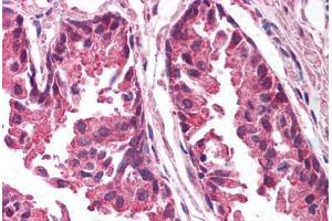 Human Prostate (formalin-fixed, paraffin-embedded) stained with TICAM1 antibody ABIN213993 at 5 ug/ml followed by biotinylated goat anti-rabbit IgG secondary antibody ABIN481713, alkaline phosphatase-streptavidin and chromogen. (TICAM1 抗体  (C-Term))