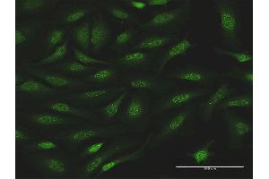 Immunofluorescence of purified MaxPab antibody to NR0B1 on HeLa cell. (NR0B1 抗体  (AA 1-470))