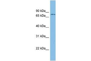 WB Suggested Anti-ADRBK1 Antibody Titration: 0.