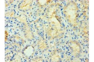 Immunohistochemistry (IHC) image for anti-Phosphatidylinositol-5-Phosphate 4-Kinase, Type II, beta (PIP4K2B) (AA 1-270) antibody (ABIN7163201)