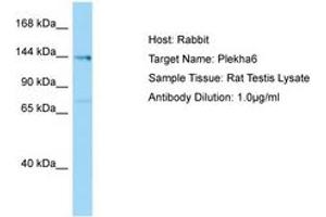 Image no. 1 for anti-Pleckstrin Homology Domain Containing, Family A Member 6 (PLEKHA6) (AA 176-225) antibody (ABIN6749876) (PLEKHA6 抗体  (AA 176-225))