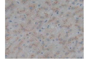 Detection of SELL in Human Liver Tissue using Polyclonal Antibody to Selectin, Leukocyte (SELL) (L-Selectin 抗体  (AA 109-346))