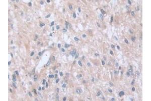 Immunohistochemistry (IHC) image for anti-Adenylyl Cyclase Associated Protein 2 (CAP2) (AA 317-455) antibody (ABIN7435160)