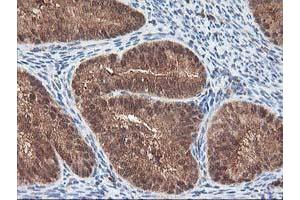 Image no. 9 for anti-Leucine Carboxyl Methyltransferase 1 (LCMT1) antibody (ABIN1499109) (LCMT1 抗体)