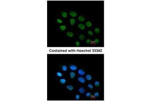 ICC/IF Image Immunofluorescence analysis of paraformaldehyde-fixed A431, using ZNF7, antibody at 1:200 dilution. (ZNF7 抗体)