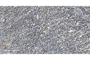 IHC analysis of Transketolase/TKT using anti-Transketolase/TKT antibody (ABIN7598958).