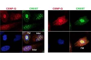 Image no. 1 for anti-Centromere Protein Q (CENPQ) antibody (ABIN401060) (CENPQ 抗体)