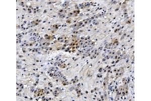 IHC analysis of HMGB3 using anti-HMGB3 antibody (ABIN7603126). (HMGB3 抗体  (N-Term))