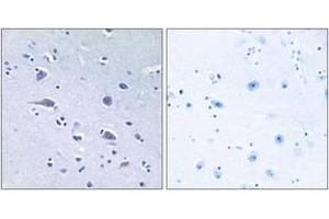 Immunohistochemistry analysis of paraffin-embedded human brain, using p70 S6 Kinase (Phospho-Thr229) Antibody.