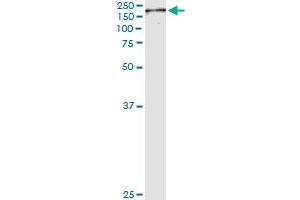 Immunoprecipitation of NUMA1 transfected lysate using anti-NUMA1 monoclonal antibody and Protein A Magnetic Bead , and immunoblotted with NUMA1 MaxPab rabbit polyclonal antibody. (NUMA1 抗体  (AA 200-306))