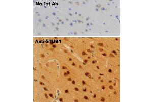 Immunohistochemistry (IHC) image for anti-STIP1 Homology and U-Box Containing Protein 1 (STUB1) antibody (ABIN6254206)