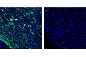 Expression of Vasopressin V1A Receptor in rat horizontal diagonal band. (AVPR1A 抗体  (Intracellular))