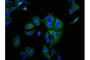 Immunofluorescence staining of HepG2 cells with ABIN7145263 at 1:200, counter-stained with DAPI. (BCAM 抗体  (AA 447-547))