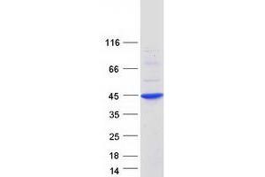 Validation with Western Blot (RCAN1 Protein (Transcript Variant 1) (Myc-DYKDDDDK Tag))