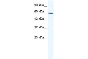 DDX5 antibody used at 1. (DDX5 抗体)