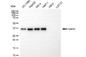 Western blotting analysis using SMN1 antibody (ABIN7800470).