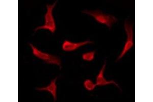 ABIN6275511 staining HeLa by IF/ICC. (EWSR1 抗体  (Internal Region))