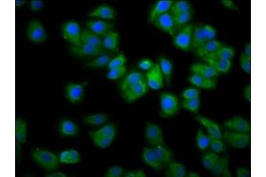 Immunofluorescence staining of HepG2 cells with ABIN7167248 at 1:133, counter-stained with DAPI. (RAB21 抗体  (AA 141-222))