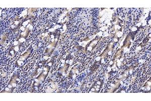 Detection of CNX in Human Small intestine Tissue using Monoclonal Antibody to Calnexin (CNX) (Calnexin 抗体  (AA 239-461))