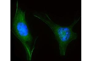 Immunofluorescent analysis of 4 % paraformaldehyde-fixed, 0. (LZIC 抗体  (AA 81-109))