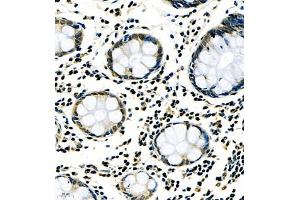 Immunohistochemistry of paraffin embedded human colon using RNF7 (ABIN7075471) at dilution of 1:1000 (400x lens)