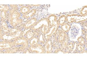 Detection of IL9 in Human Kidney Tissue using Polyclonal Antibody to Interleukin 9 (IL9) (IL-9 抗体  (AA 19-144))
