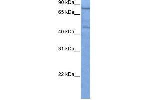 WB Suggested Anti-ZNF555 Antibody Titration:  0.