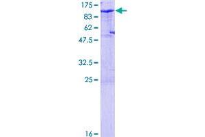 CDH6 Protein (AA 1-663) (GST tag)
