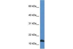 Image no. 1 for anti-Cytidine Deaminase (CDA) (C-Term) antibody (ABIN6746945) (CDA 抗体  (C-Term))