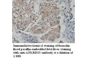 Image no. 1 for anti-Ankyrin Repeat Domain 33 (ANKRD33) antibody (ABIN1574705) (ANKRD33 抗体)