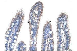 OTC antibody was used for immunohistochemistry at a concentration of 4-8 ug/ml to stain Epithelial cells of intestinal villus (arrows) in Human Intestine. (OTC 抗体  (N-Term))