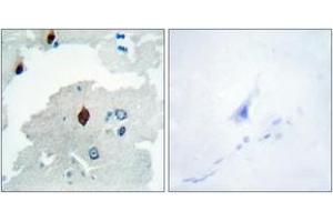 Immunohistochemistry analysis of paraffin-embedded human brain tissue, using PTTG Antibody. (PTTG1 抗体  (AA 116-165))