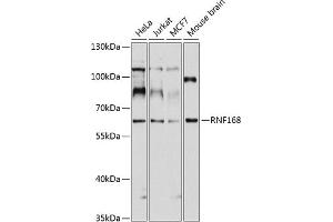 Western blot analysis of extracts of various cell lines, using RNF168 antibody (ABIN1682548, ABIN3017831, ABIN3017832 and ABIN6220281) at 1:1000 dilution. (RNF168 抗体  (AA 300-571))