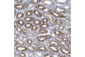 Immunohistochemical staining of human kidney with TMLHE polyclonal antibody  shows strong cytoplasmic positivity in cells in tubules. (TMLHE 抗体)