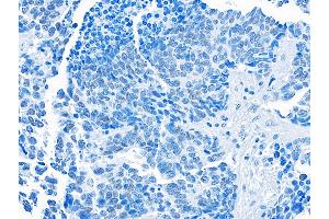 Immunohistochemistry (IHC) image for anti-Bromodomain Containing 3 (BRD3) (AA 676-726) antibody (ABIN7455203)