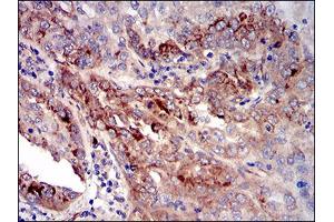 Immunohistochemistry (IHC) image for anti-Insulin-Like Growth Factor Binding Protein 7 (IGFBP7) (AA 52-156) antibody (ABIN1724903)