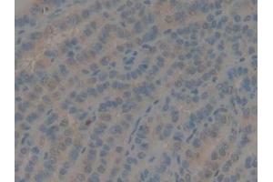 Detection of GDF10 in Human Thyroid Tissue using Polyclonal Antibody to Growth Differentiation Factor 10 (GDF10) (GDF10 抗体  (AA 337-477))