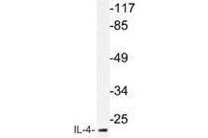 Western blot analysis of IL-4 antibody in extracts from MCF-7cells. (IL-4 抗体)
