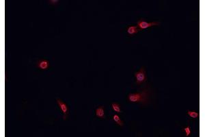 ABIN6268843 staining HeLa cells by IF/ICC. (NOTCH2 抗体)