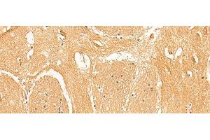 Immunohistochemistry of paraffin-embedded Human brain tissue using PPP1R1A Polyclonal Antibody at dilution of 1:50(x200) (PPP1R1A 抗体)
