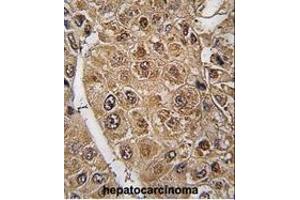 anti-Small Ubiquitin Related Modifier 2/3 (SUMO2/3) (AA 53-84), (C-Term) antibody