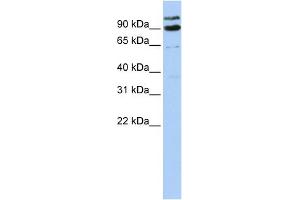 WB Suggested Anti-LONRF3 Antibody Titration:  0. (LONRF3 抗体  (Middle Region))