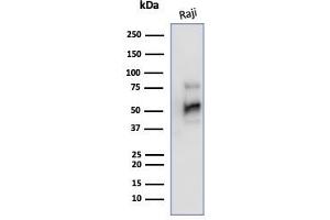 Western Blot Analysis of Raji cell lysate using CD79a Mouse Monoclonal Antibody (JCB117). (CD79a 抗体  (AA 202-216))