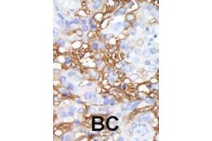 Immunohistochemistry (Paraffin-embedded Sections) (IHC (p)) image for anti-Mitogen-Activated Protein Kinase Kinase Kinase Kinase 1 (MAP4K1) (AA 321-350), (C-Term) antibody (ABIN392502)